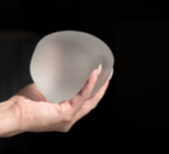 שתל אנטומי - תמונת המחשה